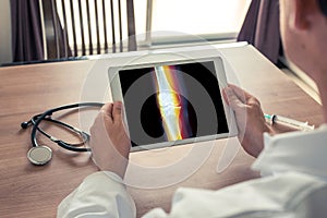 Doctor holding a digital tablet with x-ray of knee with pain on the bones and leg