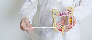 Doctor holding human Colon anatomy model. Colonic disease, Large Intestine, Colorectal cancer, Ulcerative colitis, Diverticulitis photo