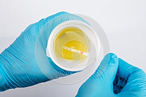 Doctor Holding Medical Urine Test In Clinic photo