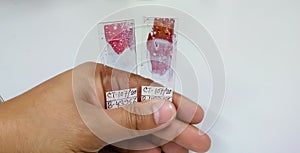 Doctor holding microscopic glass slide for the diagnosis of cytology department, Laboratory. Cytopathology