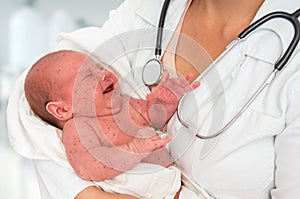 Doctor holding a newborn baby which is sick rubella or measles