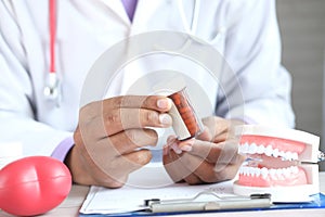 doctor holding pill container and plastic dental teeth model on table