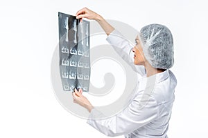 Doctor holding x-ray image