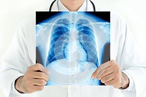 Doctor holding x-ray image of normal male chest