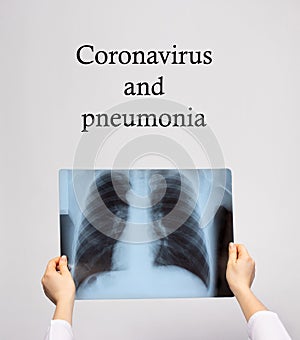 The doctor is holding an X-ray of a patient with coronavirus pneumonia. Complications of viral disease COVID-19