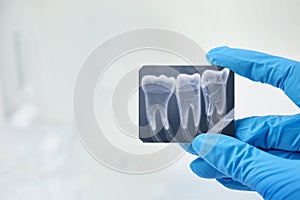 Doctor holding x-ray picture of teeth