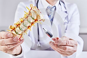 Doctor holding spine model during explanation