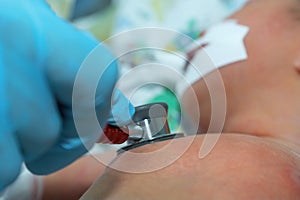 Doctor holding stethoscope in his hand and doing auscultation newborn baby on breathing machine photo