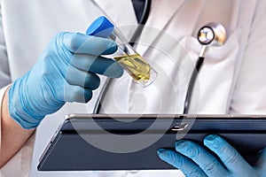 Doctor holding a tablet and analyzing the results of the urinalysis photo
