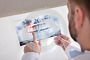 Doctor Holding Teeth X-ray