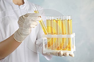 Doctor holding test tubes with urine samples for analysis on light blue background