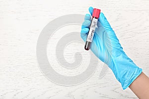 Doctor holding tube with blood and space for text