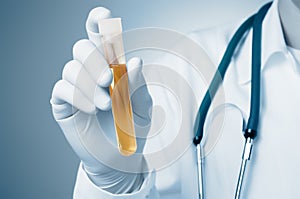 Doctor holding urine sample