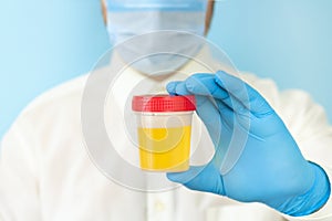 Doctor holding urine sample container for medical urinalysis