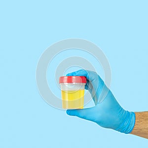 Doctor holding urine sample container for urinalysis