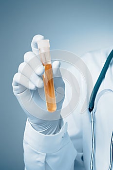 Doctor holding urine sample