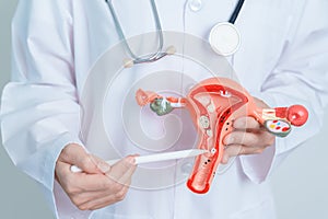 Doctor holding Uterus and Ovaries model. Ovarian and Cervical cancer, Cervix disorder, Endometriosis, Hysterectomy, Uterine photo