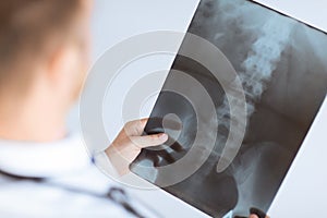 Doctor holding x-ray or roentgen image photo