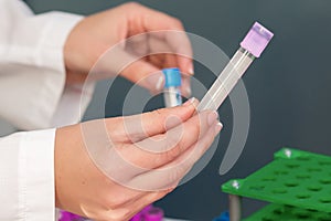 Doctor`s hands holding sample tubes