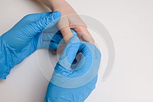 Doctor holds child hand with warts on thumb. Papillomavirus in child, close-up. Verruca vulgaris. HPV. Pediatric