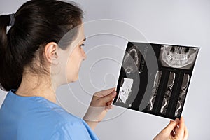 The doctor holds a CT scan of a patient with temporomandibular joint dysfunction and malocclusion.