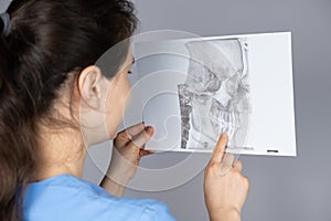 The doctor holds a CT scan of a patient with temporomandibular joint dysfunction and malocclusion.