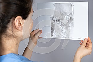 The doctor holds a CT scan of a patient with temporomandibular joint dysfunction and malocclusion.