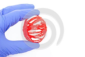 Doctor holds an egg with red threads in a medical glove the concept of male disease varicocele and varicose veins, copy space