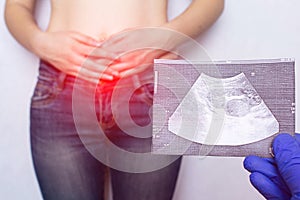 Doctor holds in his hand a snapshot of medical ultrasound examination on the background of a girl with a hernia in the abdomen