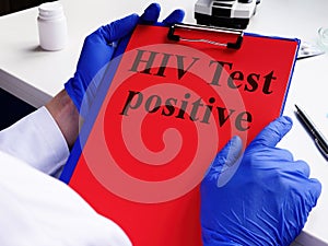 Doctor holds HIV test positive. HIV/Aids concept