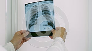 A doctor holds a human X-ray in his hand,to study a person`s illness,pneumonia,diagnose in the hospital,a close-up of pulmonary ed