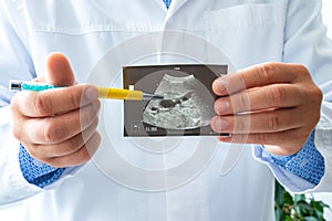 Doctor holds before itself and shows patient printed picture with ultrasound examination of gallbladder, pointing with a pen on ga