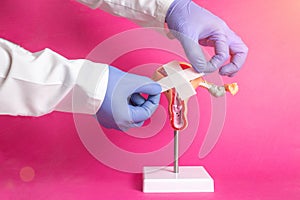 The doctor holds a medical plaster near the model of the girl's gynecological system on a pink background. Sexually