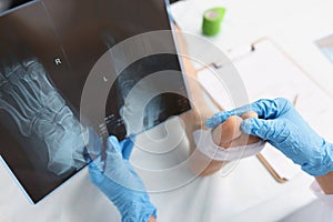 Doctor holds x-ray with dislocated leg of patient lying on table