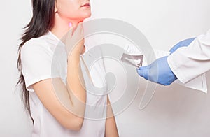 The doctor holds the results of examination of the girl`s throat in his hands. Concept of symptoms and sore throat in coronavirus photo
