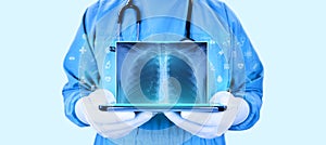 The doctor holds a tablet and examines a chest x-ray in digital format.