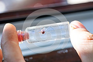 A doctor holds a test tube with an ixodic tick