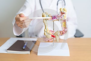 Doctor with human Colon anatomy model. Colonic disease, Large Intestine, Colorectal cancer, Ulcerative colitis, Diverticulitis, photo