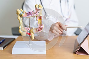 Doctor with human Colon anatomy model and tablet. Colonic disease, Large Intestine, Colorectal cancer, Ulcerative colitis, photo