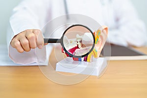 Doctor with human Ear anatomy model with magnifying glass. Ear disease, Atresia, Otitis Media, Pertorated Eardrum, Meniere photo
