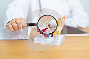 Doctor with human Ear anatomy model with magnifying glass. Ear disease, Atresia, Otitis Media, Pertorated Eardrum, Meniere