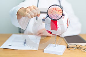 Doctor with human Eye anatomy model with magnifying glass. Eye disease, Refractive Errors, Age Related Macular Degeneration,