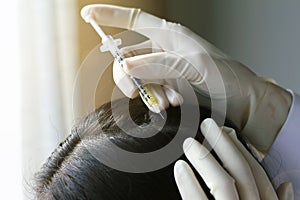 Doctor injecting at patient`s hair and scalp, Close up shot of Dermatologist exam scalp disorder.