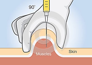 Doctor insert medications into the muscle tissue with injection needle.