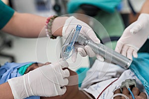 Doctor intubate double lumen endotracheal tube photo