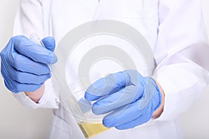 A doctor, lab technician in blue gloves holding urine sample in a plastic container, urinalysis and filling the pipette