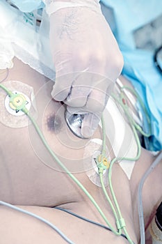 Doctor listens to the patient's heartbeat