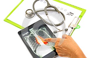 Doctor looking chest x-ray image on tablet