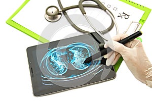 Doctor looking chest x-ray image on tablet