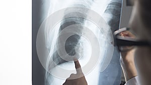 Traumatology surgeon roentgenogram X-ray photo
